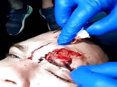 That's gonna leave a good scars