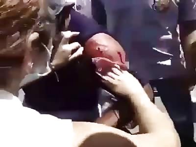 Venezuelan protester gets shot in the arm.