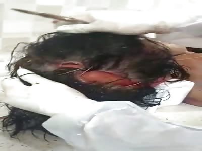 [Very weird autopsy] Opening skull of dead woman in morgue 