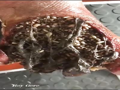 Dinner Anyone? Rotten Arm Full of Maggots 