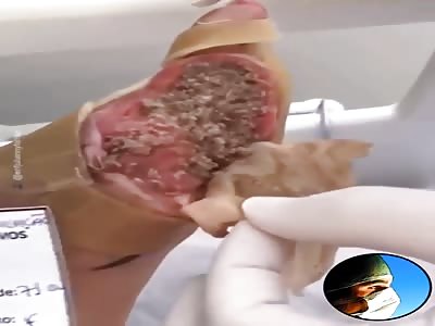 Man foot full of maggots under his skin