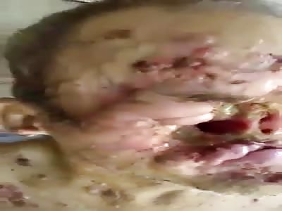 SHOCKING, MAN EATEN BY WORMS