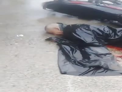 BIKER FALLS NEED A NEW LEG