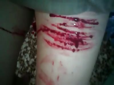 Depressed girl self cutting 