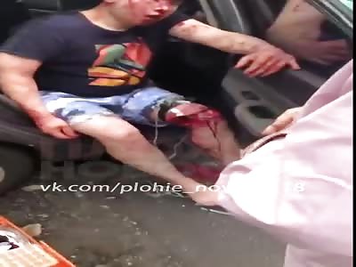 Horrific accident leave 4 dead and one victim with horrible leg injury