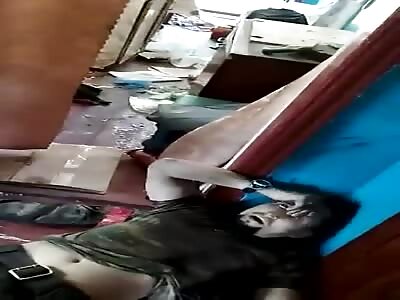 Chechenian mercenarie with smashed legs