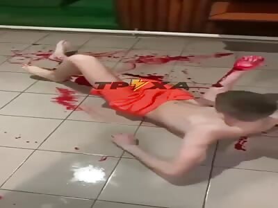 Drunk guy fly into glass door ,he cut the tendon and piece of muscle 