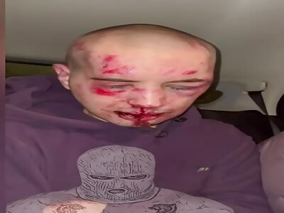 Drug users must pay for their debts 