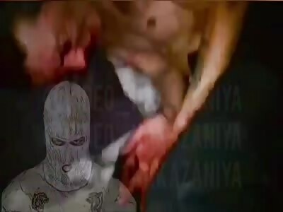 Two middle finger broken after bloody beating 