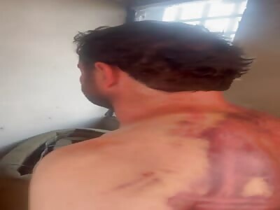 Worker showing of his body to police after he get tortured by his boss