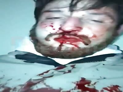 Group of young Chechenian beat Russian for selling drugs 