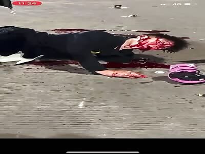 Young man victime of horrific motorcycle accident 