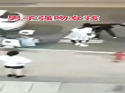 Removing his hair wig was a bad idea 