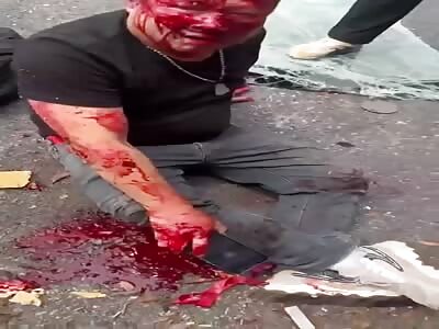 Bus driver victim of shocking accident with truck 