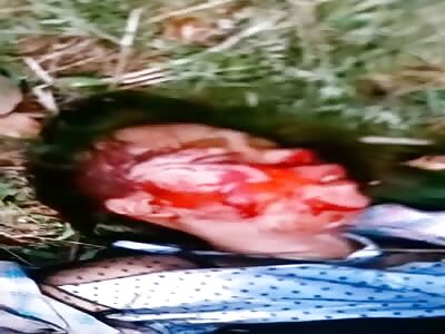 Chinese Girl Victim of Crash (Still Alive, Barley)