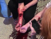 Chinese girl Knife attack after argument for ex-boyfriend 