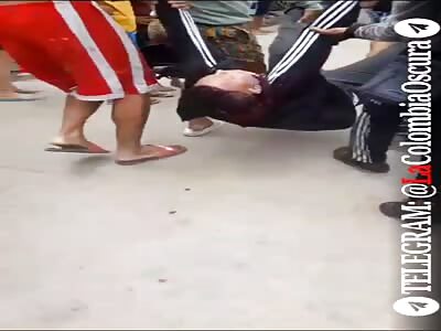 Armed robbery victim transported on motorcycle to the hospital 