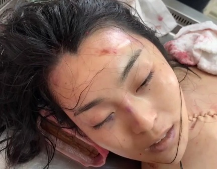 Chinese cute girl from the morgue 