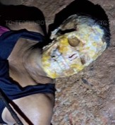 DAMN: Piranhas Ate a Woman's Face