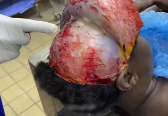 《35:00 minutes vid》postmortem examination on a dead black woman 