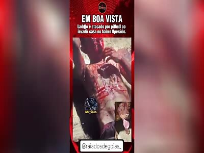 Thief attacked by pit Bull 