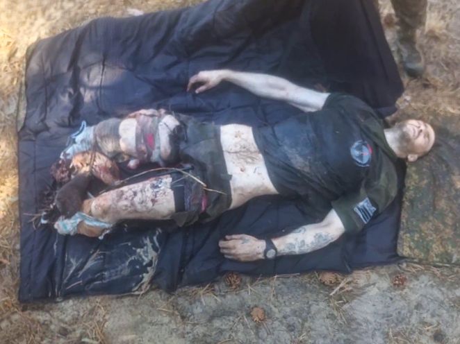 Russian with Legs Blown Off Suffering Demonic Pain