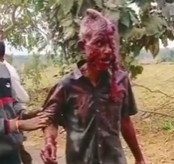 Man Escapes from a Tiger, but....