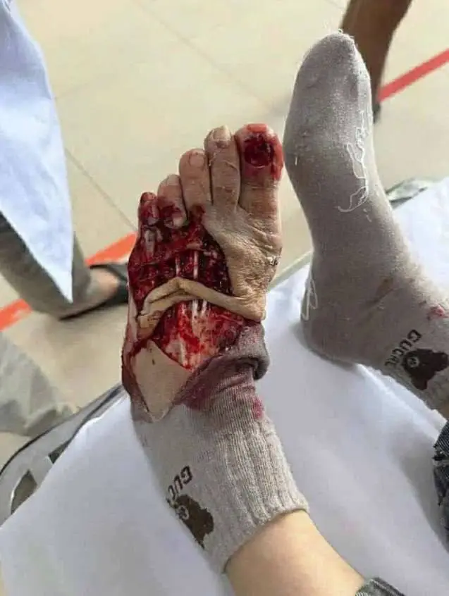 Man run over by crane