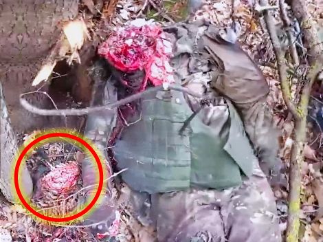 Daily Death Count Finds Intact Brain Neatly Beside Russian