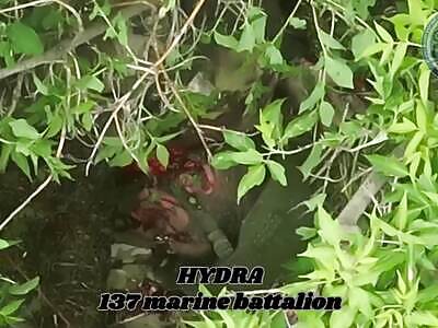 Checking the vital organs of Russians.