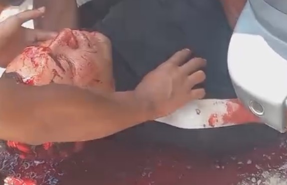 Man Shot During Robbery Dies Of Blood Loss