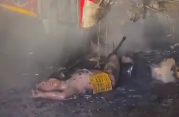 Moped Owner Left With Head Deformed After Fiery Crash