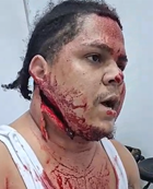 Man Slashed In The Face During Fight