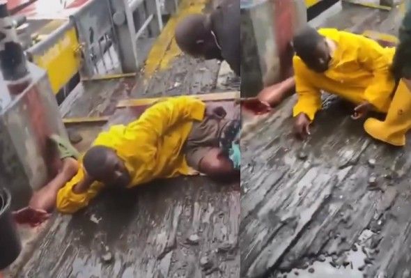Fisherman`s Leg Ripped Off By Rope