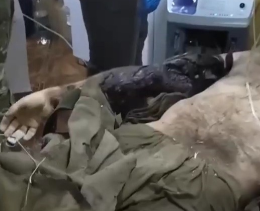 Two wounded Russian soldiers hospitalized 