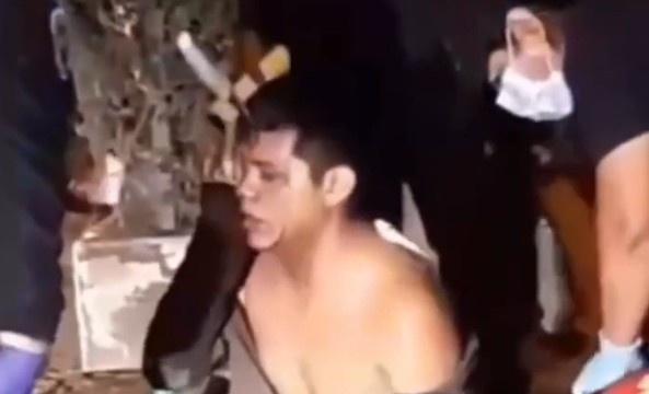 JUST A KNIFE STUCK IN THE FOREHEAD