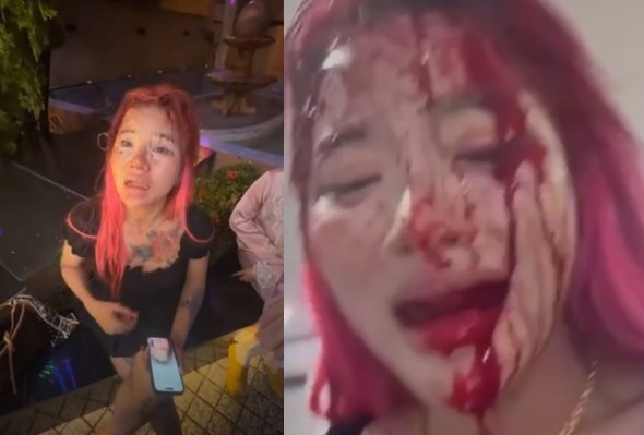 Chinese Girl Films Herself Bleeding After She Was Assaulted, Mugged