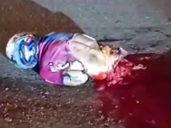 Biker  Still  Somehow Alive After He Cut In Half