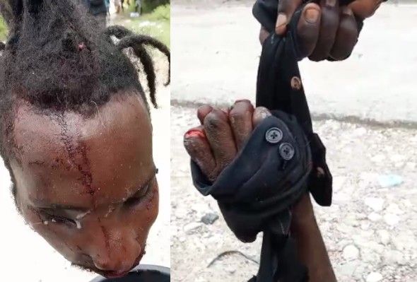 Haitian Gang Member Became A Puzzle