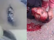 Biker Dying After Crushed Into Pickup