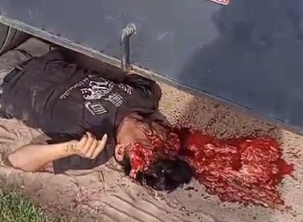 The man suffered an accidental crushing injury.