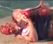 Biker In Agony Trying To Fix His Broken Arm