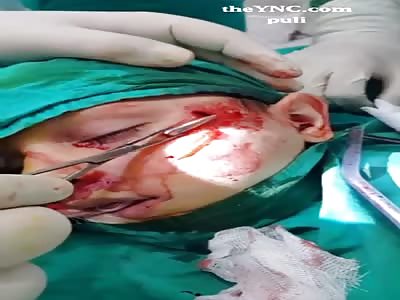 boy I shot in the face