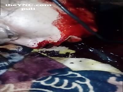 Beheaded for drug debt