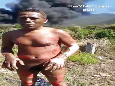 Fire by taking clandestine in city mendoza veracruz,