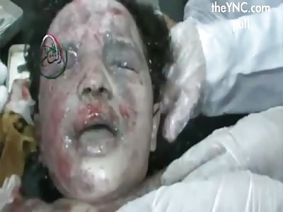 Consequences of air strikes