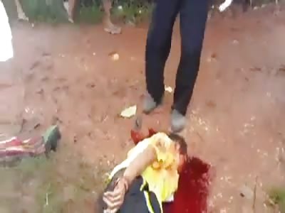 This little boy was out playing when he was hit by a vehicle.