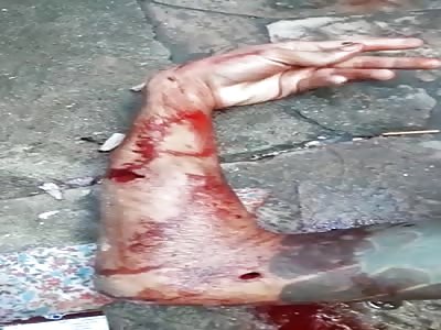 Homicide at Vila Ellenry (Brazil) more than 10 shot of 9 mm caliber gun ....