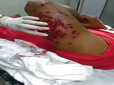 prisoners.shot by the police