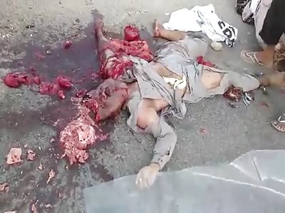 BODY COMPLETELY CRUSHED AFTER ACCIDENT OF MOTORCYCLE AND TRUCK